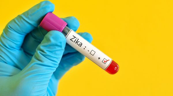 zika-test-tube_1500_thinkstockphotos-506041030