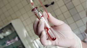 hiv 1