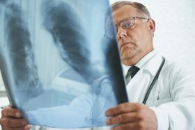 pneumonie
