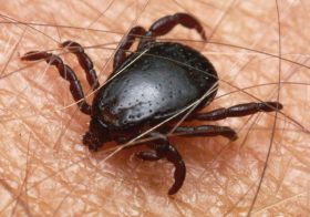 A close up of a tick feeding on a human arm. South Africa.